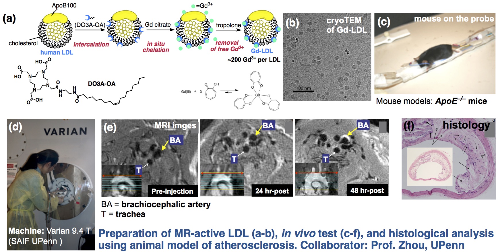 Enlarged view: nLDL